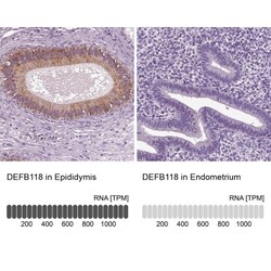 DEFB118 Antibody, Novus Biologicals:Antibodies:Primary Antibodies